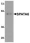 Spermatogenesis Associated 6 antibody, LS-C144444, Lifespan Biosciences, Western Blot image 