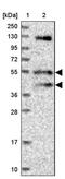 Fuzzy Planar Cell Polarity Protein antibody, PA5-59909, Invitrogen Antibodies, Western Blot image 