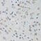 5-Hydroxytryptamine Receptor 3A antibody, LS-C334187, Lifespan Biosciences, Immunohistochemistry paraffin image 