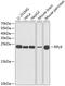 60S ribosomal protein L9 antibody, A6406, ABclonal Technology, Western Blot image 