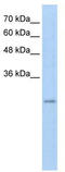 Ret Finger Protein Like 3 antibody, TA329800, Origene, Western Blot image 