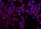 Matrix Metallopeptidase 16 antibody, A05065, Boster Biological Technology, Immunofluorescence image 