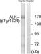 ALK Receptor Tyrosine Kinase antibody, TA312959, Origene, Western Blot image 