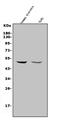 Matrix Metallopeptidase 28 antibody, A07364-1, Boster Biological Technology, Western Blot image 
