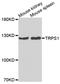 Transcriptional Repressor GATA Binding 1 antibody, A7743, ABclonal Technology, Western Blot image 