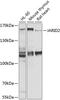 Jumonji And AT-Rich Interaction Domain Containing 2 antibody, A01969, Boster Biological Technology, Western Blot image 