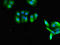 RAB27A, Member RAS Oncogene Family antibody, LS-C679259, Lifespan Biosciences, Immunofluorescence image 