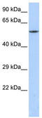 Calcium Voltage-Gated Channel Auxiliary Subunit Beta 1 antibody, TA341719, Origene, Western Blot image 