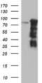 Forkhead Box P1 antibody, NBP2-45713, Novus Biologicals, Western Blot image 