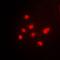 Tumor Protein P63 antibody, orb214808, Biorbyt, Immunofluorescence image 