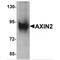 Axin-2 antibody, TA319745, Origene, Western Blot image 