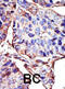 Serine/threonine-protein kinase BGLF4 antibody, abx033843, Abbexa, Immunohistochemistry frozen image 