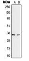 Ring Finger Protein 113B antibody, GTX55212, GeneTex, Western Blot image 