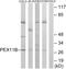 Peroxisomal Biogenesis Factor 11 Beta antibody, GTX87266, GeneTex, Western Blot image 