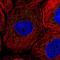 CTD Small Phosphatase 2 antibody, NBP1-85958, Novus Biologicals, Immunocytochemistry image 