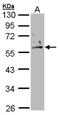 Keratin 2 antibody, NBP1-31423, Novus Biologicals, Western Blot image 