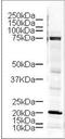 LIM domain kinase 1 antibody, orb345493, Biorbyt, Western Blot image 