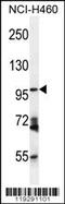 Glutamyl Aminopeptidase antibody, 56-223, ProSci, Western Blot image 