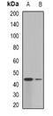 Galactose-1-Phosphate Uridylyltransferase antibody, abx141831, Abbexa, Western Blot image 