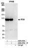 Importin-9 antibody, A305-474A, Bethyl Labs, Immunoprecipitation image 