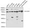 CT-1 antibody, GTX55800, GeneTex, Western Blot image 