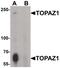 Testis And Ovary Specific PAZ Domain Containing 1 antibody, PA5-38060, Invitrogen Antibodies, Western Blot image 