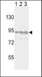Discoidin Domain Receptor Tyrosine Kinase 2 antibody, LS-C99151, Lifespan Biosciences, Western Blot image 