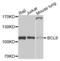 BCL6 Transcription Repressor antibody, LS-C346261, Lifespan Biosciences, Western Blot image 