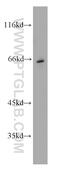 High affinity choline transporter 1 antibody, 21848-1-AP, Proteintech Group, Western Blot image 
