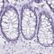 Sarcalumenin antibody, PA5-59616, Invitrogen Antibodies, Immunohistochemistry frozen image 
