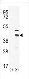 Docking Protein 4 antibody, 63-149, ProSci, Western Blot image 