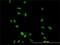 Cyclin H antibody, H00000902-M01, Novus Biologicals, Immunocytochemistry image 