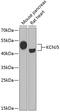 Potassium Voltage-Gated Channel Subfamily J Member 5 antibody, 22-070, ProSci, Western Blot image 