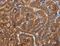 Bone Morphogenetic Protein 6 antibody, MBS2519651, MyBioSource, Immunohistochemistry frozen image 