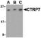 C1q And TNF Related 7 antibody, A16229, Boster Biological Technology, Western Blot image 