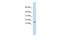 Adipogenesis Associated Mth938 Domain Containing antibody, GTX45288, GeneTex, Western Blot image 