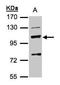 Mannosidase Beta antibody, GTX103124, GeneTex, Western Blot image 
