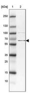 Zinc Finger BED-Type Containing 5 antibody, PA5-62284, Invitrogen Antibodies, Western Blot image 