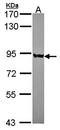 Polyribonucleotide Nucleotidyltransferase 1 antibody, orb69833, Biorbyt, Western Blot image 