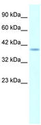H6 Family Homeobox 1 antibody, TA330636, Origene, Western Blot image 