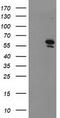 Protein arginine N-methyltransferase 2 antibody, TA503622AM, Origene, Western Blot image 