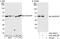 Rho GTPase Activating Protein 1 antibody, A301-853A, Bethyl Labs, Immunoprecipitation image 