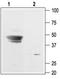 Potassium Voltage-Gated Channel Subfamily J Member 9 antibody, TA328944, Origene, Western Blot image 