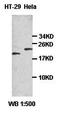Putative adenosylhomocysteinase 2 antibody, orb77421, Biorbyt, Western Blot image 