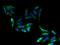 ELOVL Fatty Acid Elongase 2 antibody, A67990-100, Epigentek, Immunofluorescence image 