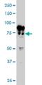 Beaded Filament Structural Protein 1 antibody, H00000631-M02, Novus Biologicals, Western Blot image 