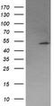 Protein Phosphatase, Mg2+/Mn2+ Dependent 1B antibody, TA502866S, Origene, Western Blot image 