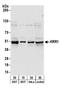 KRR1 Small Subunit Processome Component Homolog antibody, A303-898A, Bethyl Labs, Western Blot image 