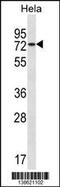 Inactive ubiquitin-specific peptidase 39 antibody, 60-055, ProSci, Western Blot image 