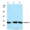 Claudin 5 antibody, LS-B11331, Lifespan Biosciences, Western Blot image 